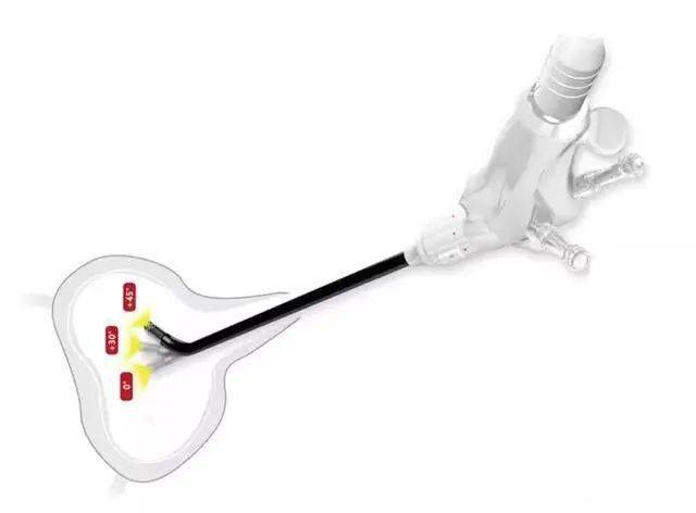 注冊(cè)審批、上市流通...未來15年，醫(yī)療器械這些環(huán)節(jié)將迎來產(chǎn)業(yè)變革！ 