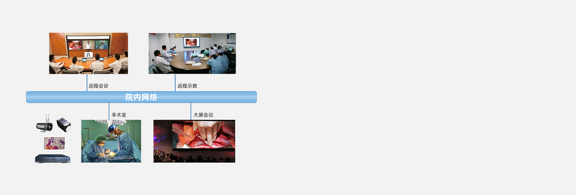 高清攝像系統(tǒng)【選配】