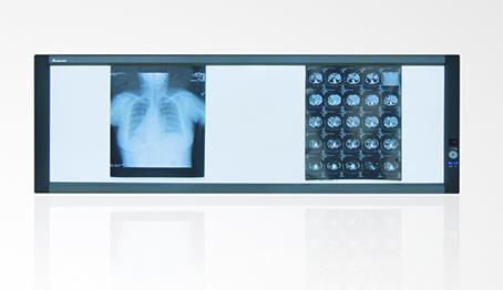 高頻醫(yī)用觀片燈應(yīng)該如何選擇？