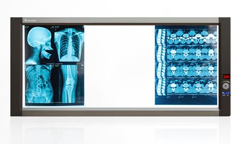 醫(yī)用觀(guān)片燈ZG-3B的功率及參數(shù)介紹